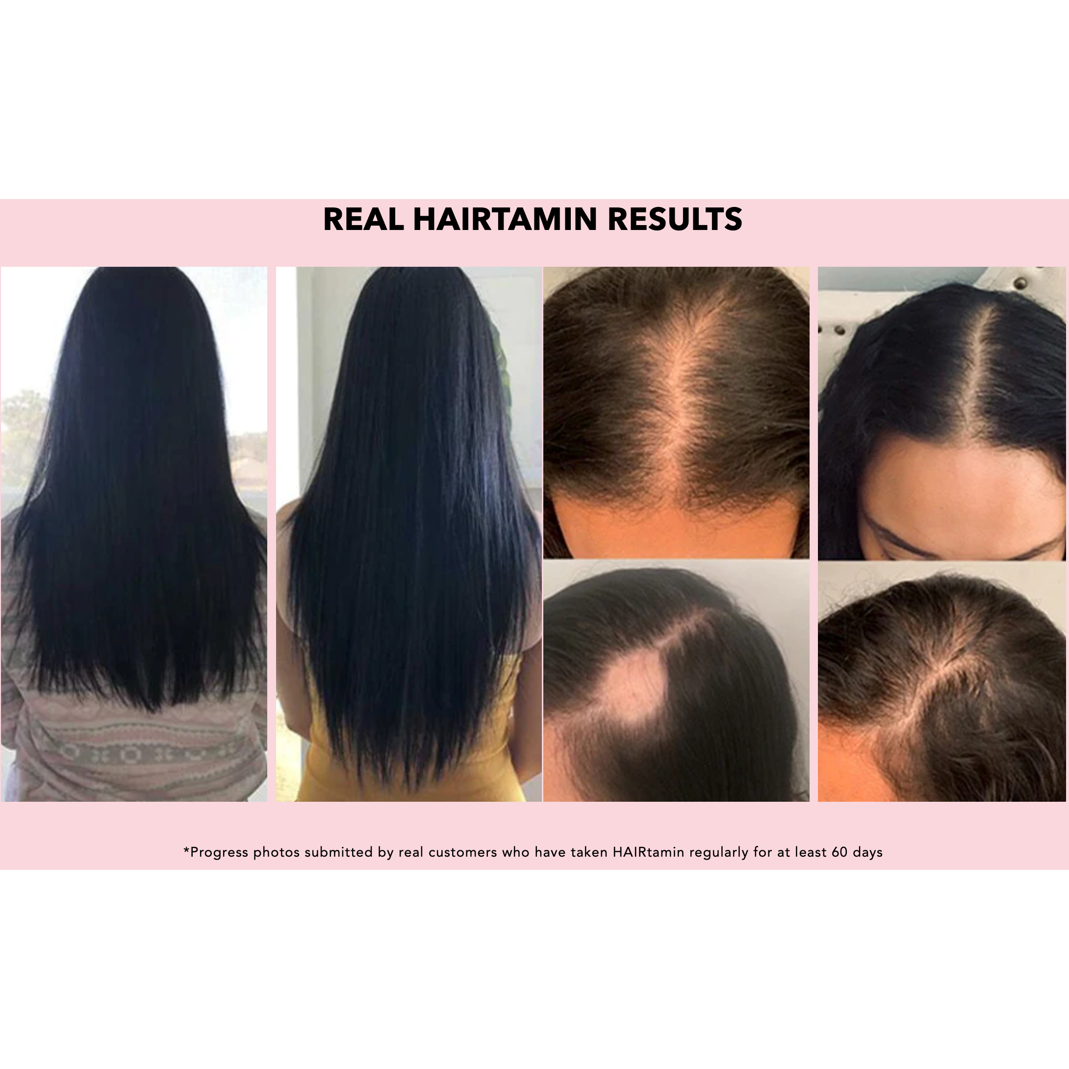 فيتامينات الشعر النباتية من هيرتامين لنمو أسرع للشعر مع البيوتين الطبيعي لدعم صحة الشعر والبشرة والأظافر، 30 كبسولة نباتية